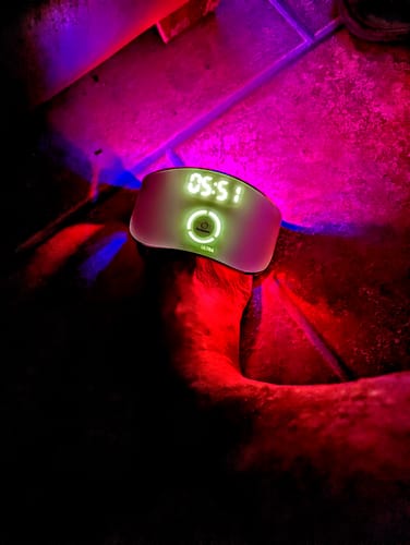 Customer photo review of Onychom - Antifungal Laser Device