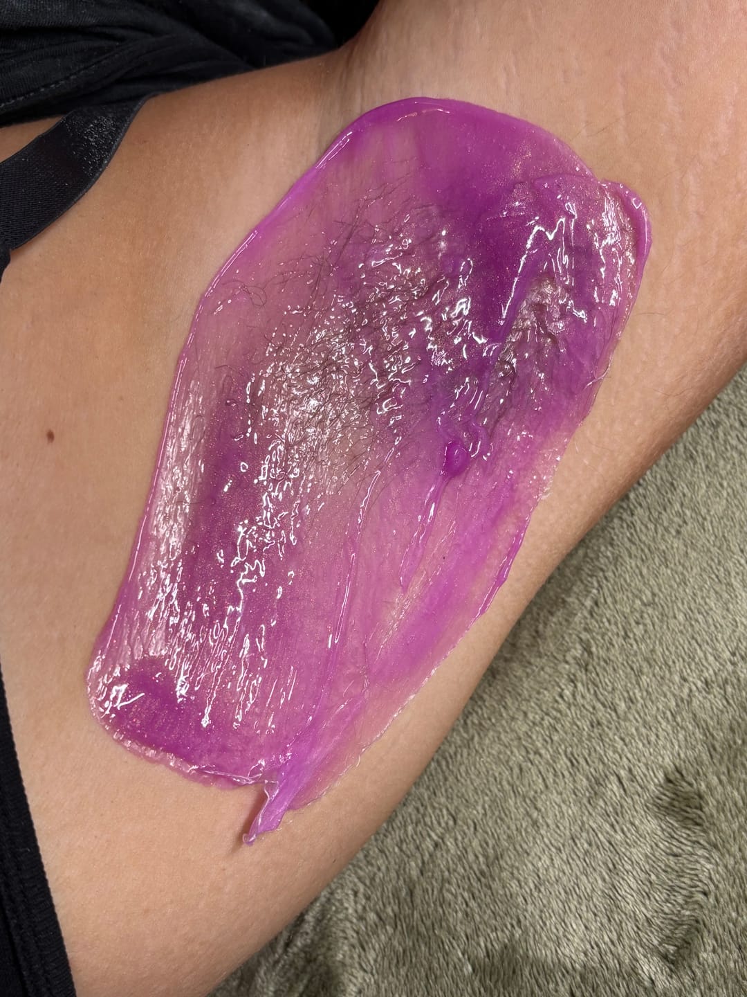 Customer photo review of Signature Series Hair Removal Wax