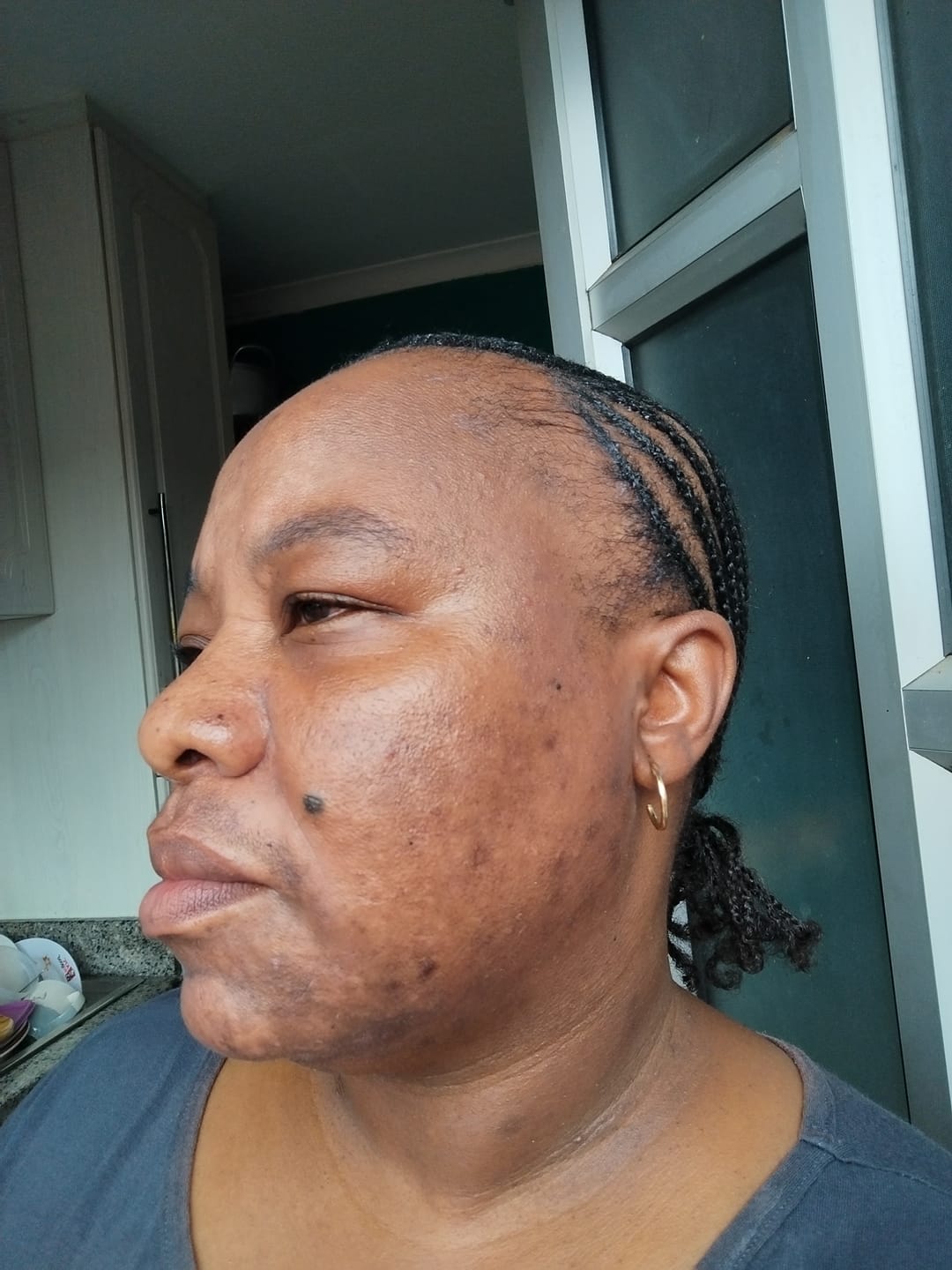 Customer photo review of Gmaeum Radiance and Renewal Set
