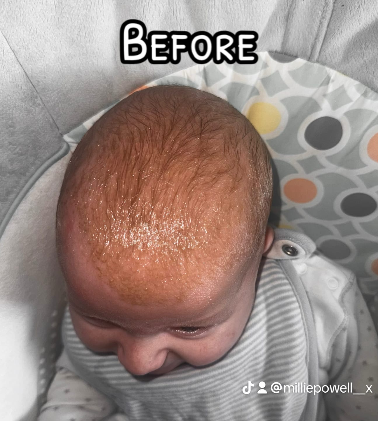Customer photo review of Baby Scalp Oil