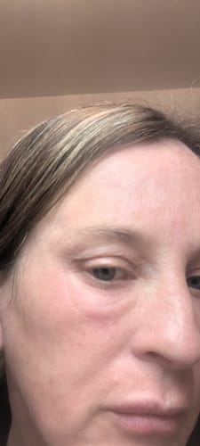 Customer photo review of Glov Micro Infusion System