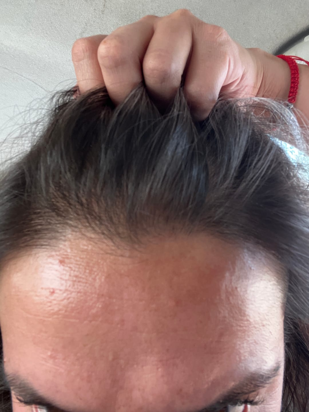 Customer photo review of Pack Anticaída de Cabello para 1 Mes