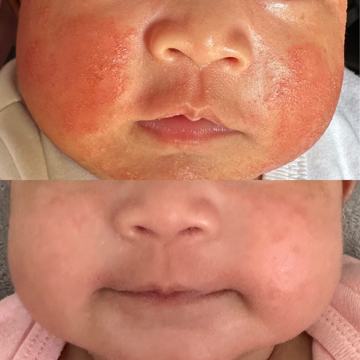 Customer photo review of Manuka Moisturising Baby Butter
