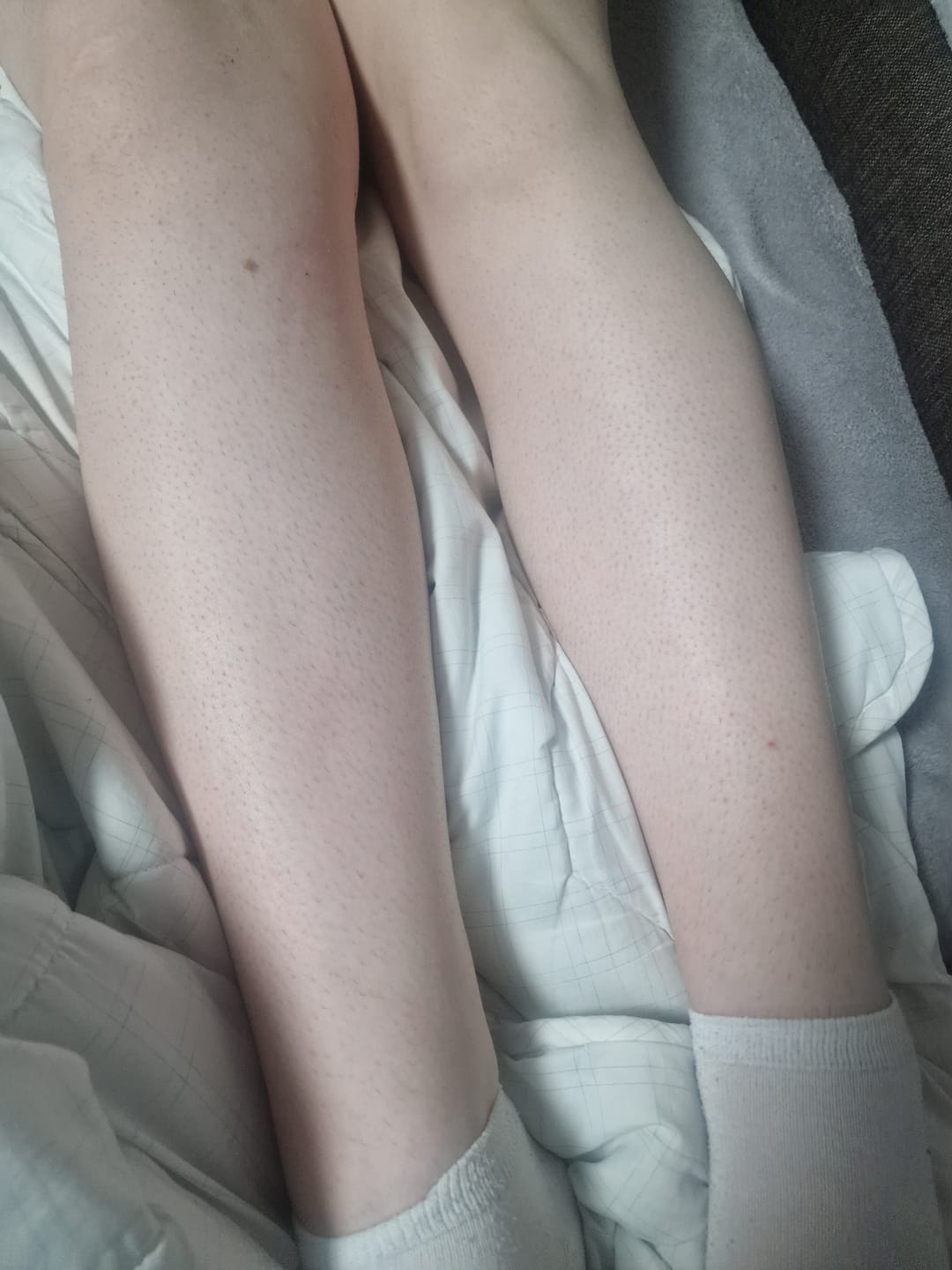 Customer photo review of 5x Belle Body Haarentfernung inkl. Gratis Enthaarungscreme
