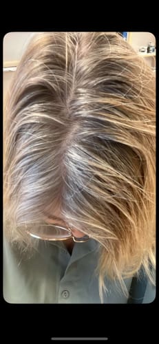 Customer photo review of Sunkissed Refill 1-pack