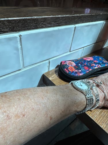 Customer photo review of Self Tanning 150 Capsules