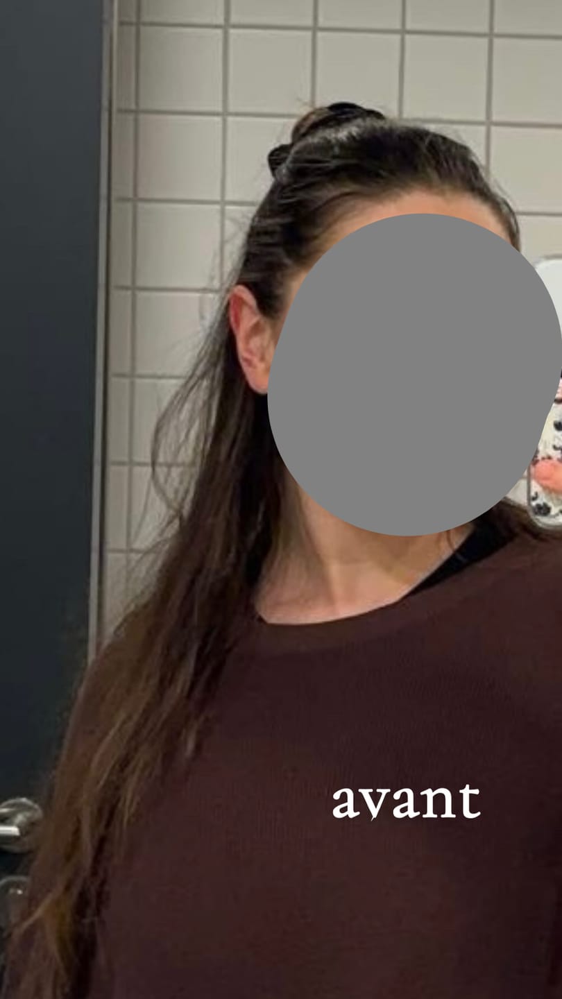 Customer photo review of Shampoing Solide Gingembre Anti chute & Pousse de cheveux - ECLAMA
