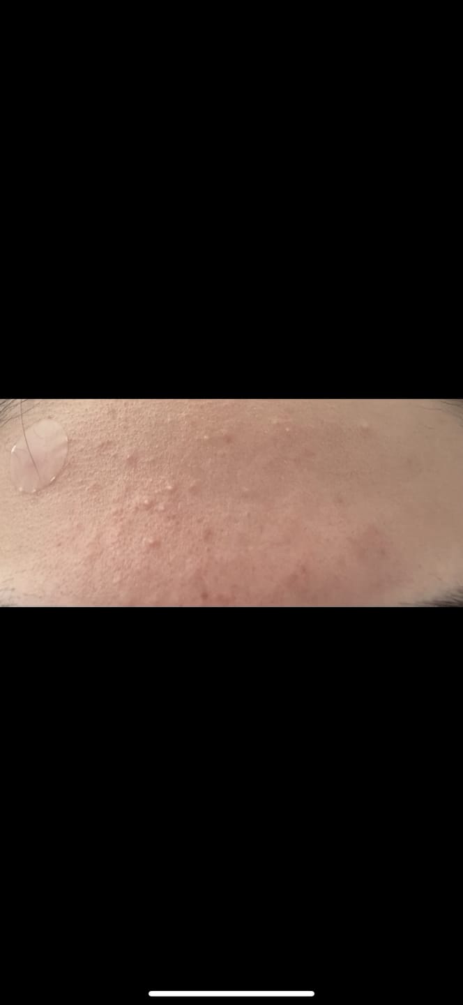Customer photo review of ⚡ Australia’s Turmeric Clay Mask