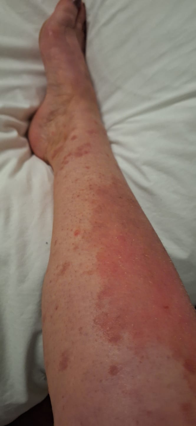 Customer photo review of Body Cream with Chia Seed Oil