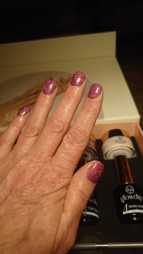 Customer photo review of Verzending Verzekering