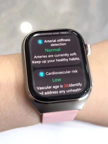 Customer photo review of Smart Ring R02 – Dein diskreter Fitness- & Gesundheitsbegleiter