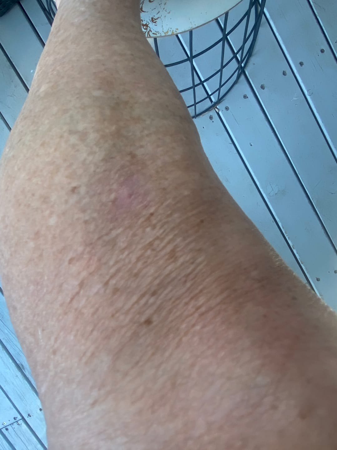 Customer photo review of MAGNESIUM SUPER STICK