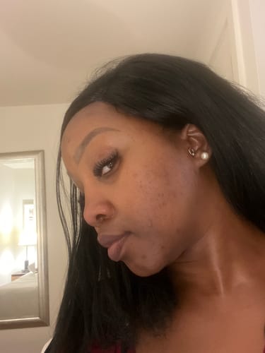 Customer photo review of Turmeric Glow Soap