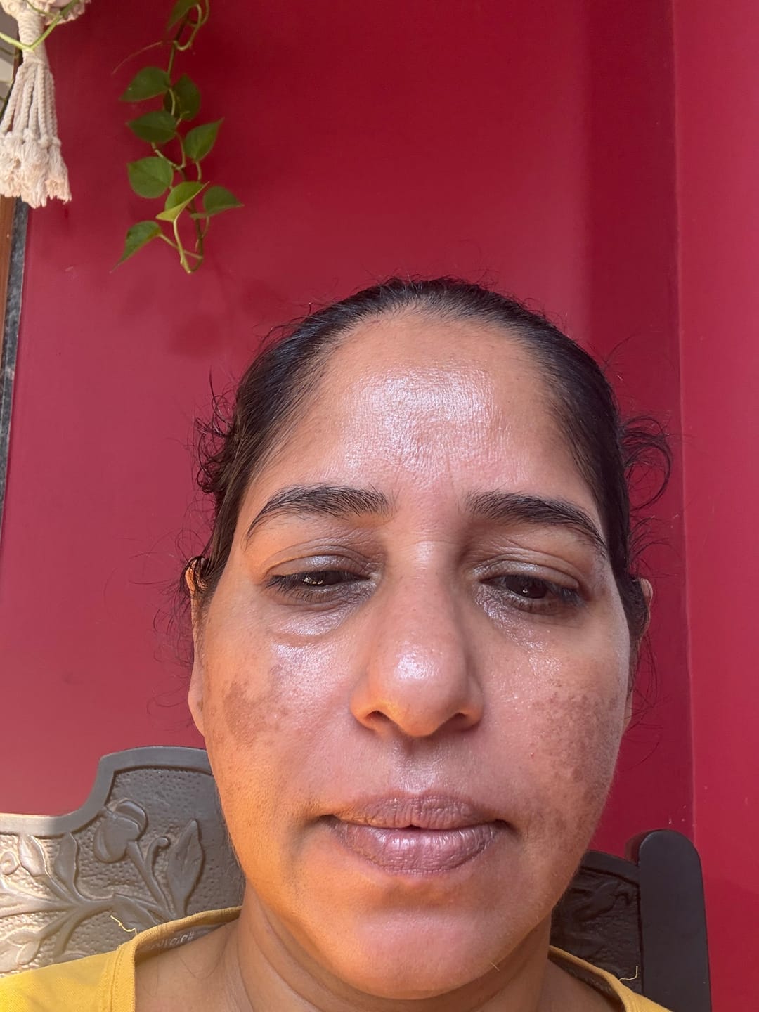 Customer photo review of Medbrite Serum