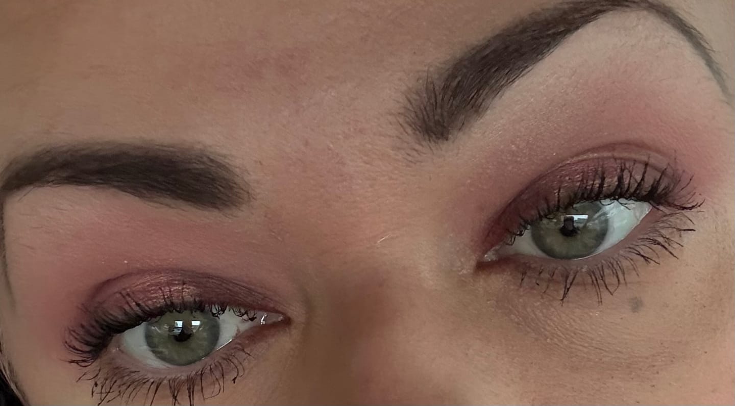 Customer photo review of EYELASH GROWTH SOLUTION
