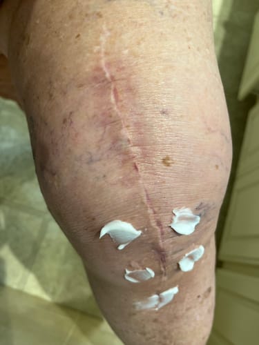 Customer photo review of Mama Bear Nerve Relief Lotion