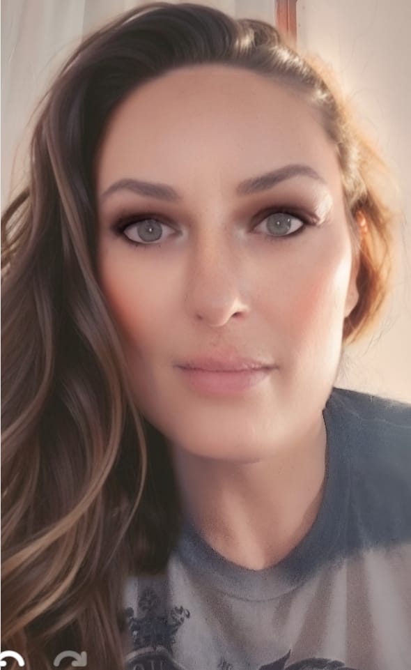 Customer photo review of Vega Bright Forest Green Prescription Colored Contact Lenses