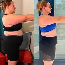 Customer photo review of LumaLean Pro - For Menopause Belly