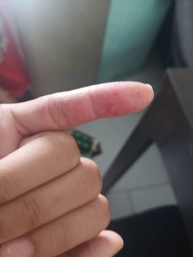 Customer photo review of Jolicare Cream