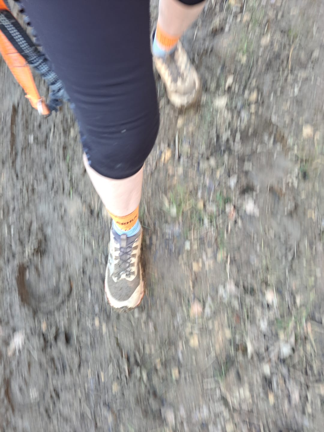 Customer photo review of Bamboo Ankle Compression Support Sleeve For Achilles Tendon And Ankle Sprains