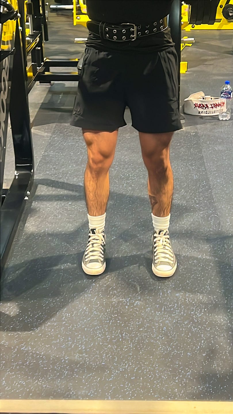 Customer photo review of 101 Bodybuilding Short Shorts