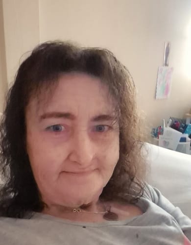 Customer photo review of Anti-Aging treatment