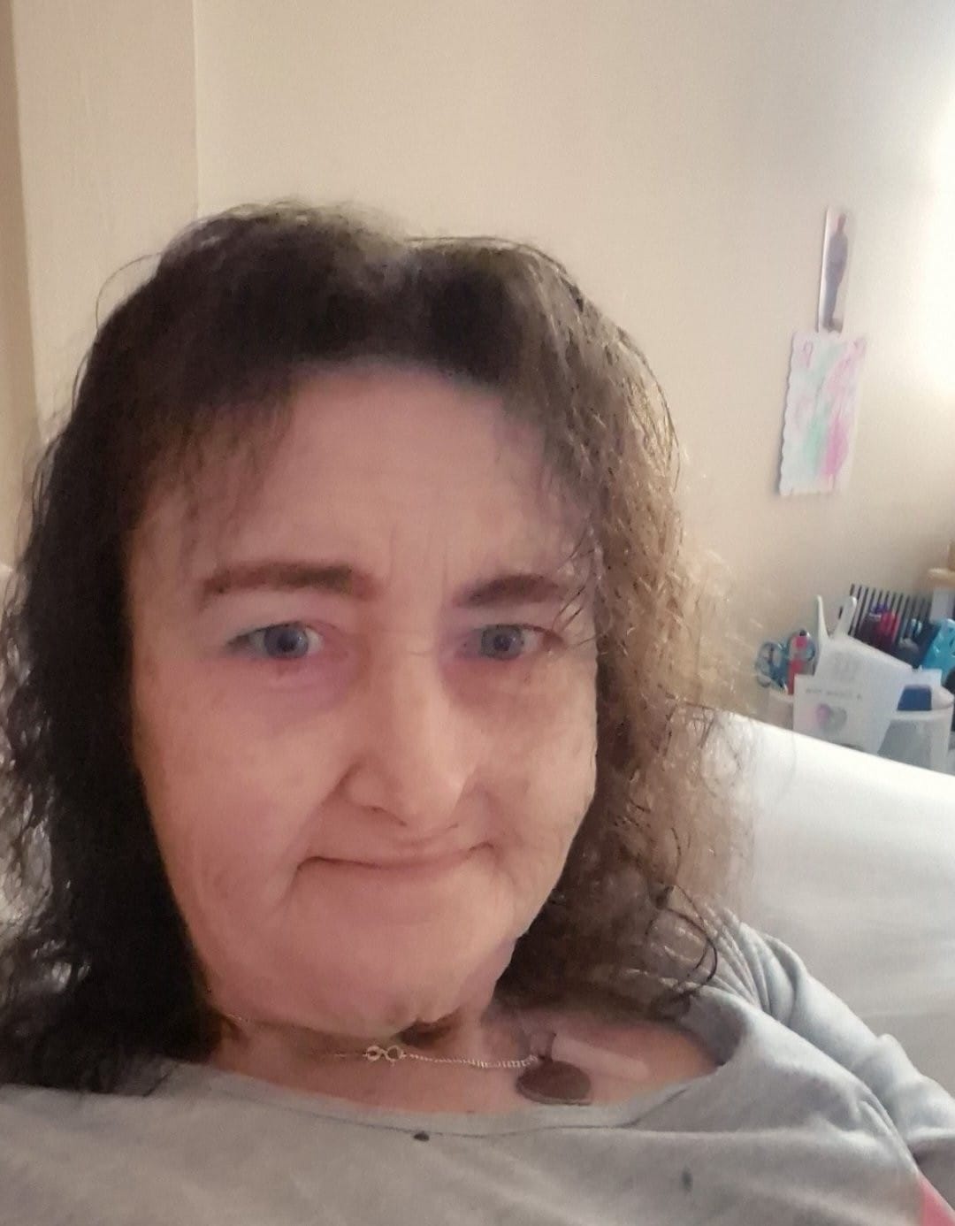 Customer photo review of Anti-Aging treatment