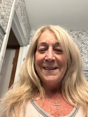 Customer photo review of 2-Pack Bundle - Liftlab Sculpting Serum