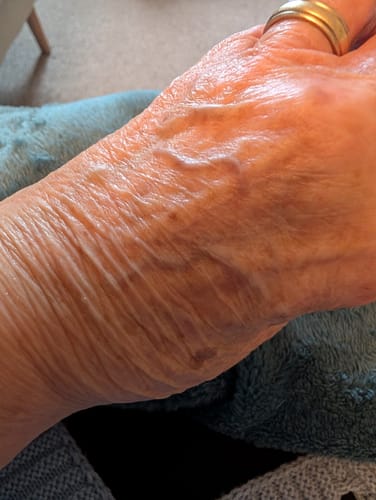 Customer photo review of Calm Balm