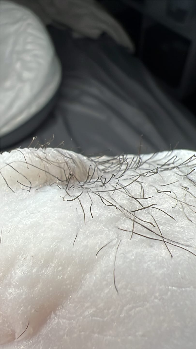 Customer photo review of Signature Series Hair Removal Wax