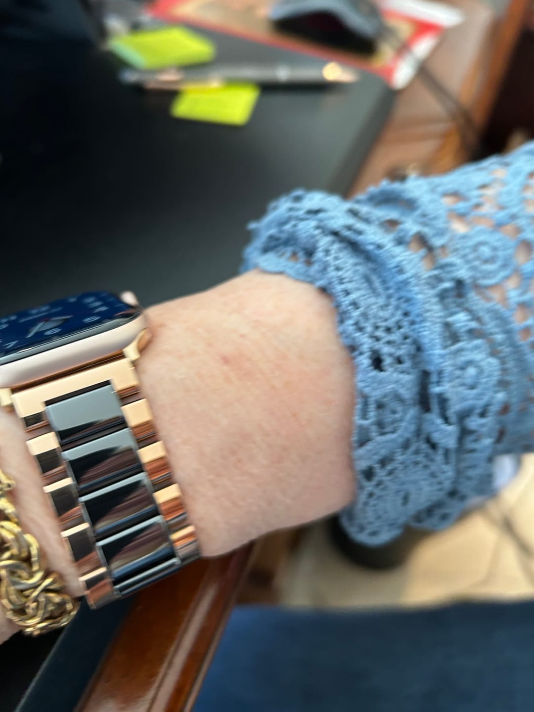 Customer photo review of Granum Ceramic Strap