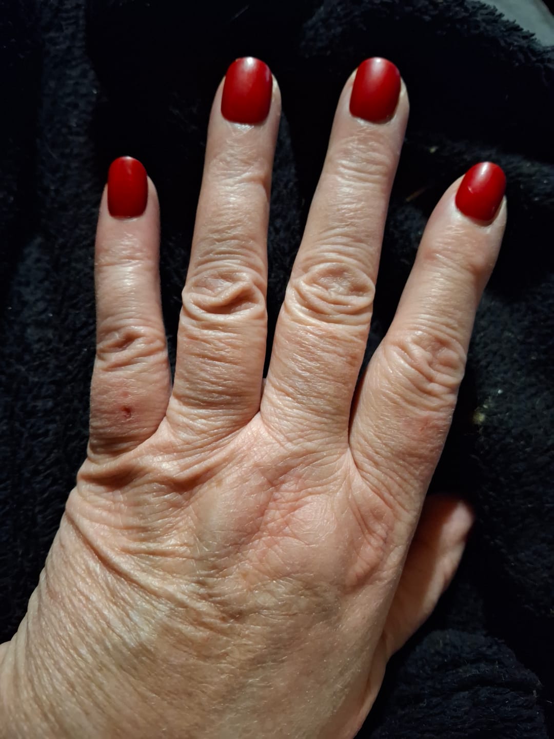 Customer photo review of Poppy