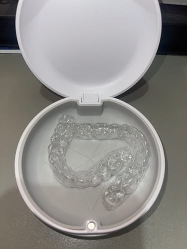Customer photo review of Essix Retainers