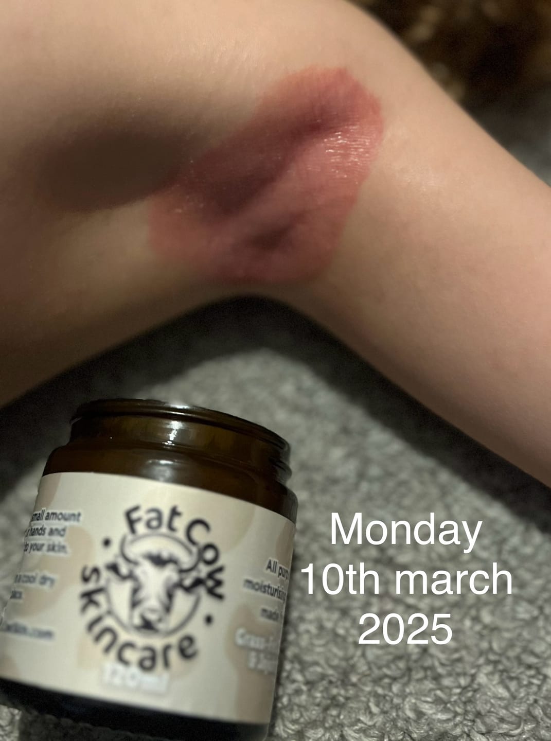 Customer photo review of Head to Toe Bundle | Body & Face Tallow
