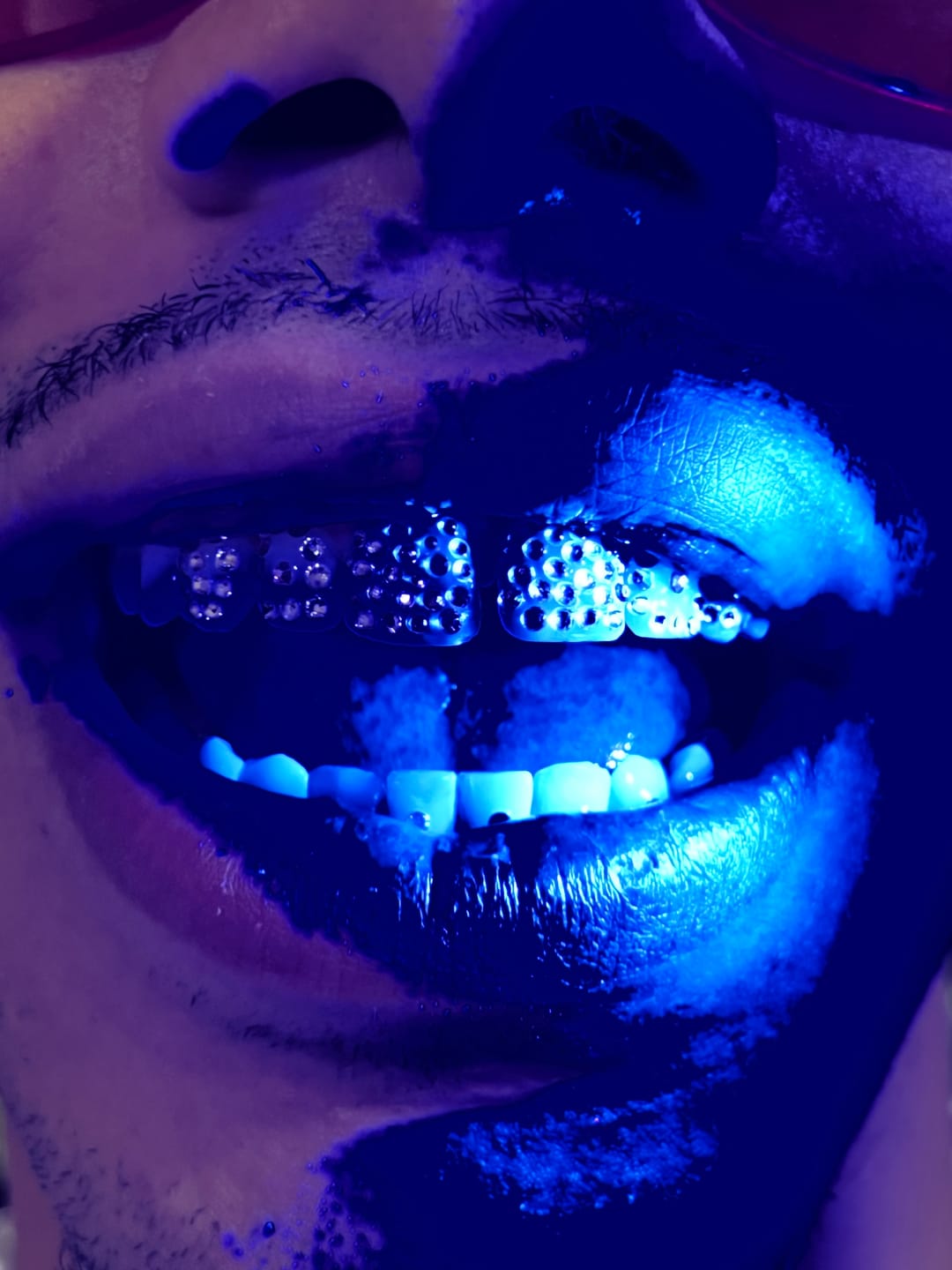 Customer photo review of Gemas Dentales Preciosa - Crystal