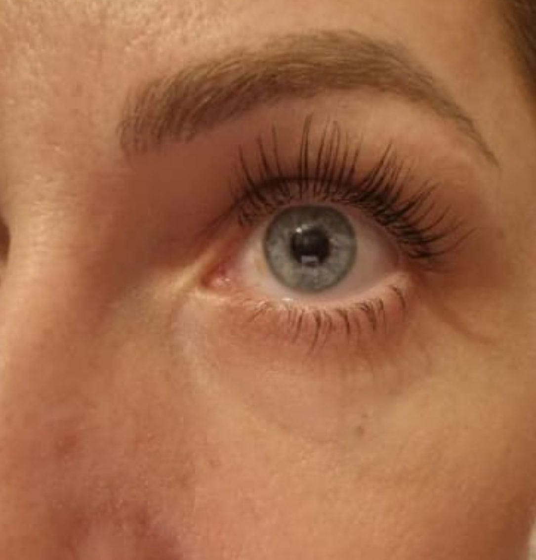 Customer photo review of Eyelash Growth Serum
