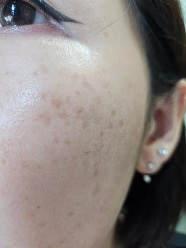 Customer photo review of OUTGLOW - Radiance Tri-Factor™ Jelly