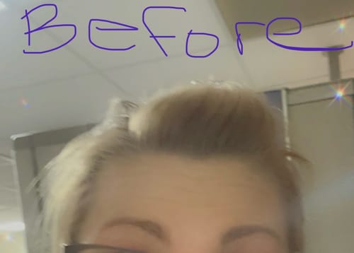 Customer photo review of Glov Hair Regrowth System