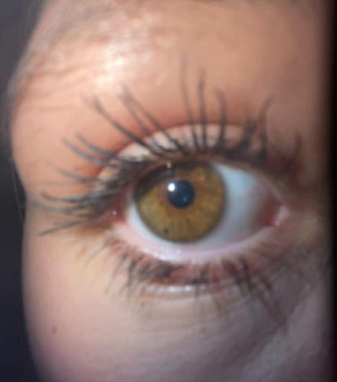 Customer photo review of Eyelash Growth Serum