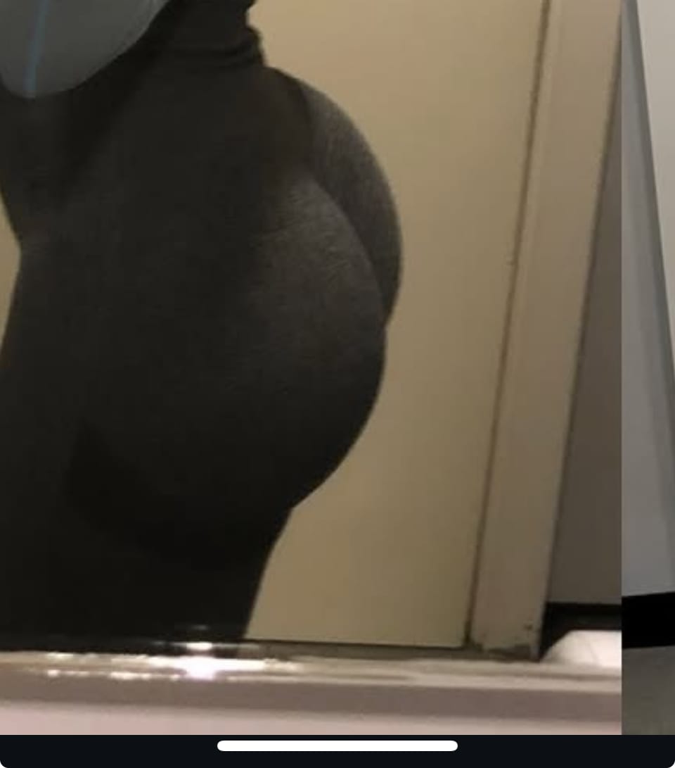 Customer photo review of Butt Enlargement Oil Serum - Natural Curves Serum