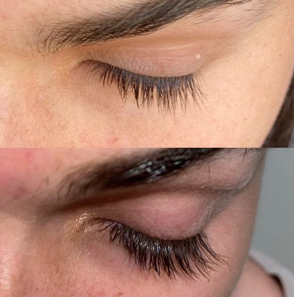 Customer photo review of Eyelash Growth Serum