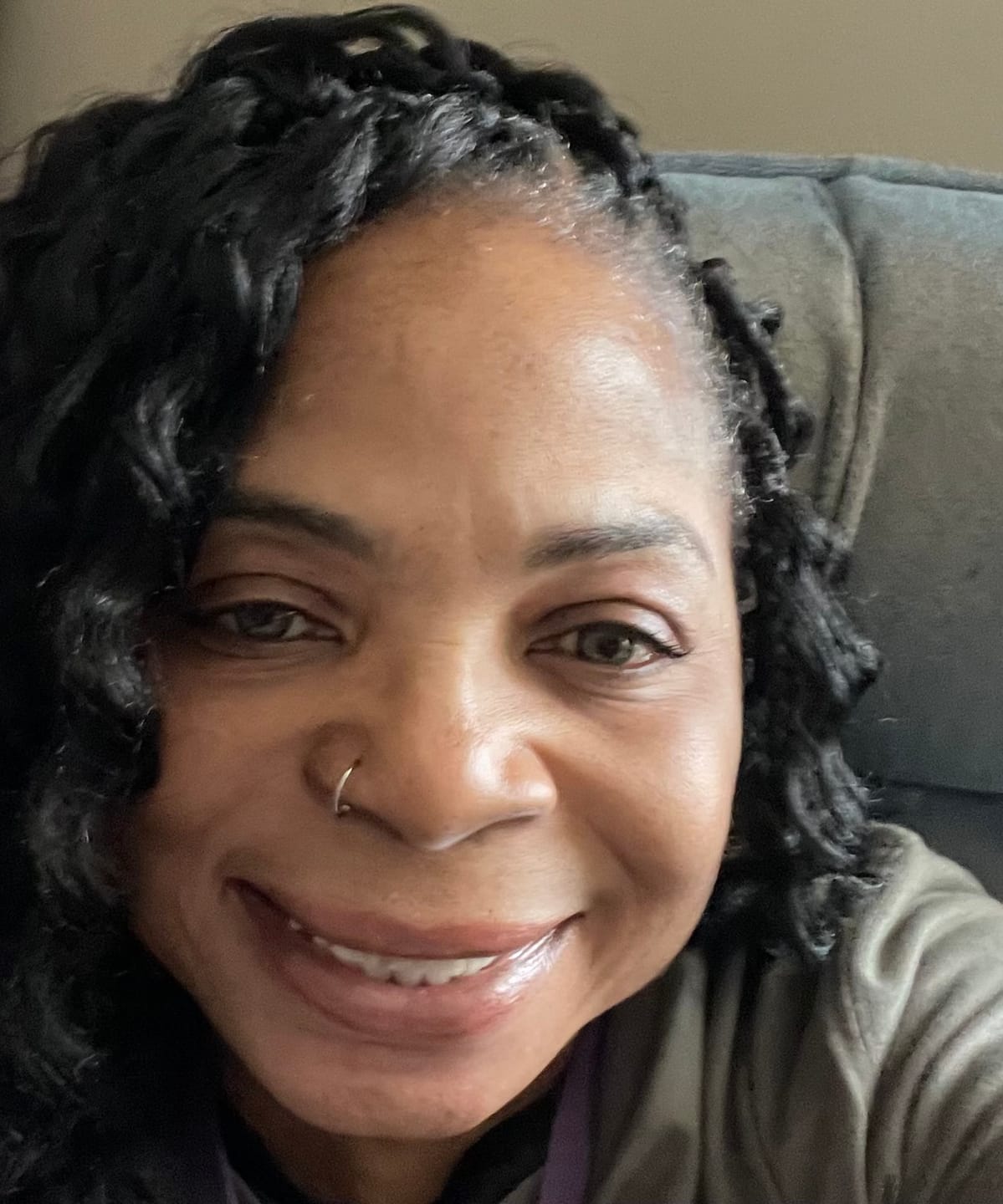 Customer photo review of LightenUp Anti-Aging Clarifying Gel - 30g / 1 Oz