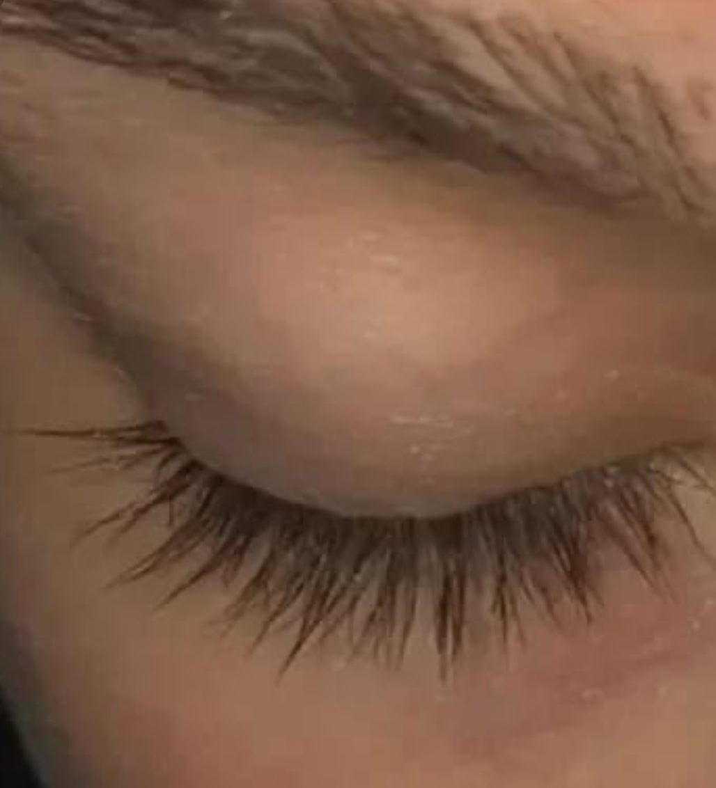 Customer photo review of Eyelash Growth Serum