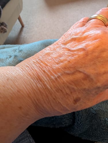 Customer photo review of 5-Step Clear Skin Kit