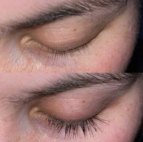Customer photo review of Eyelash Growth Serum