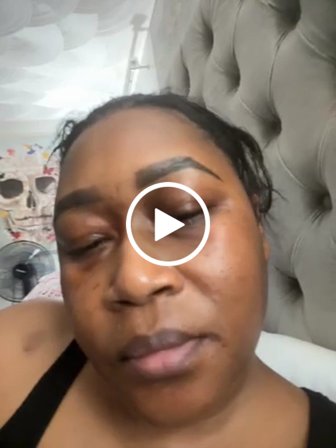 Customer video review of LIMITED EDITION: Jolie’s Mini Full Body & Face Brightening Kit/ Acne Kit