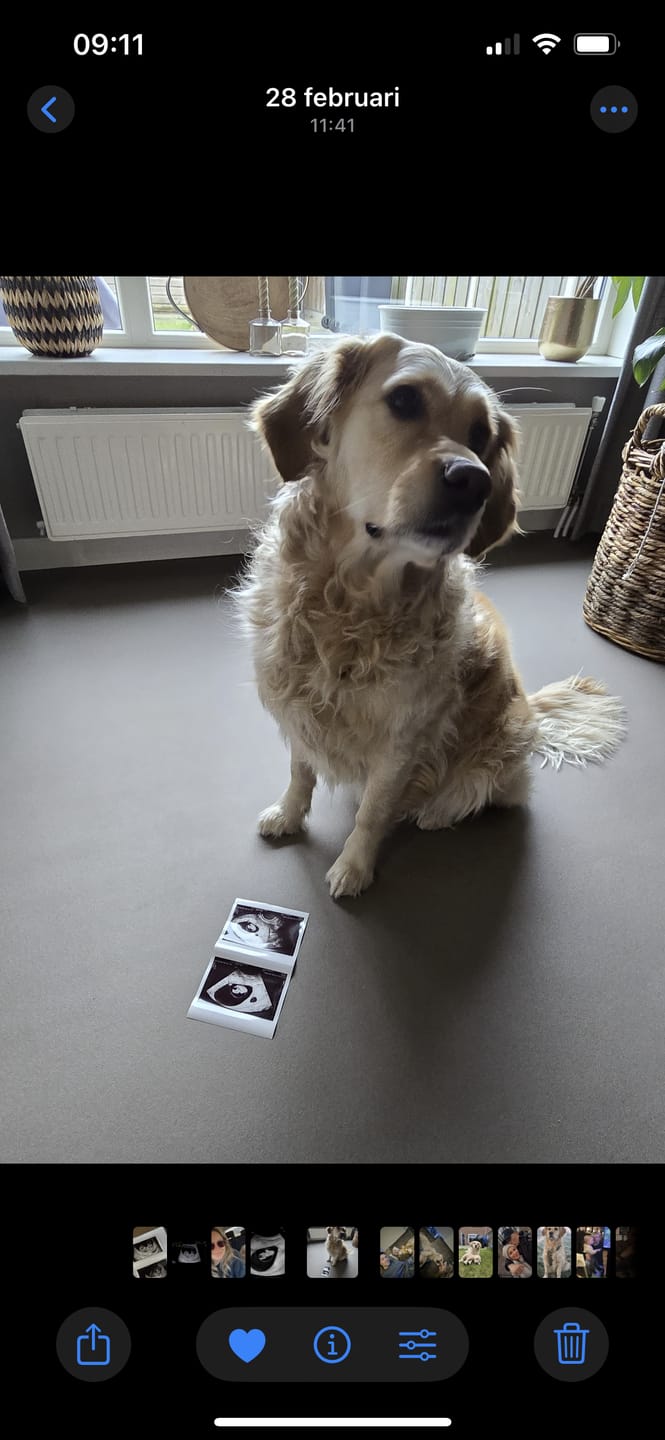 Customer photo review of Vitamines Zwangerschap - 1e Trimester Bundel
