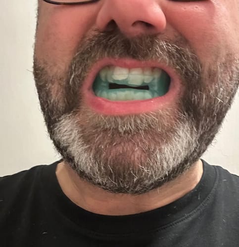 Customer photo review of SleepPro Custom AM