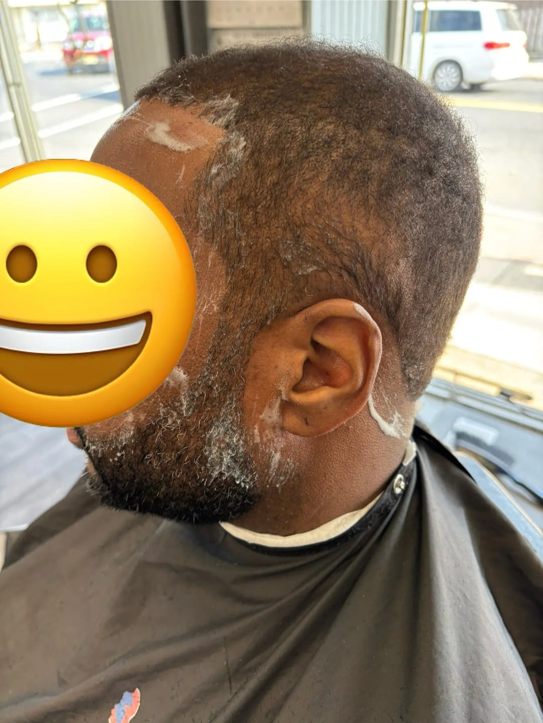 Customer photo review of 100 Packs - FreShape Up