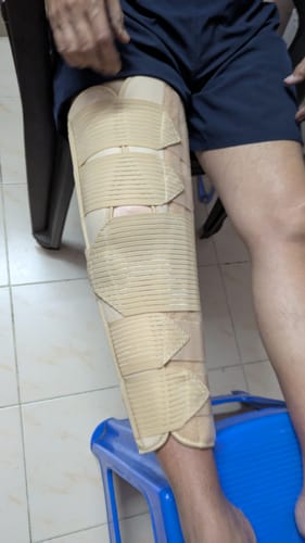 Customer photo review of Knee Brace - Long (19" Brace) | Ideal firm Knee support that limits knee motion & stabilizes the knee with mediolateral metal supports | Color - Beige
